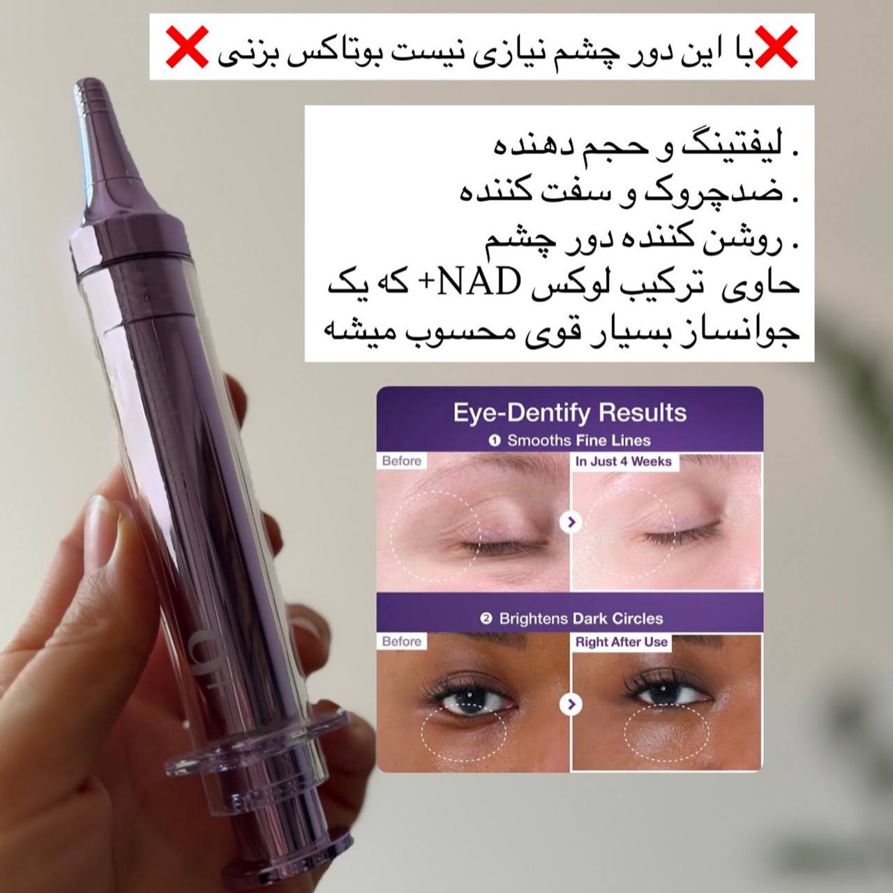 کرم دور چشم نامبوزین شماره 9 