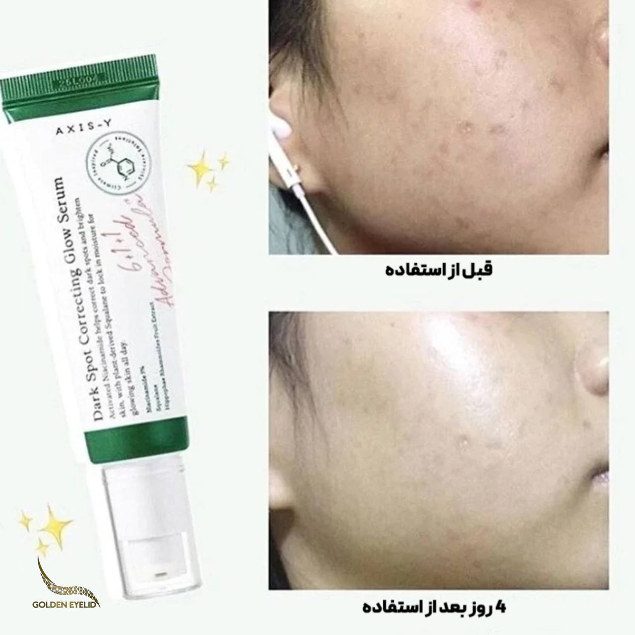 ضدلک اکسیس وای